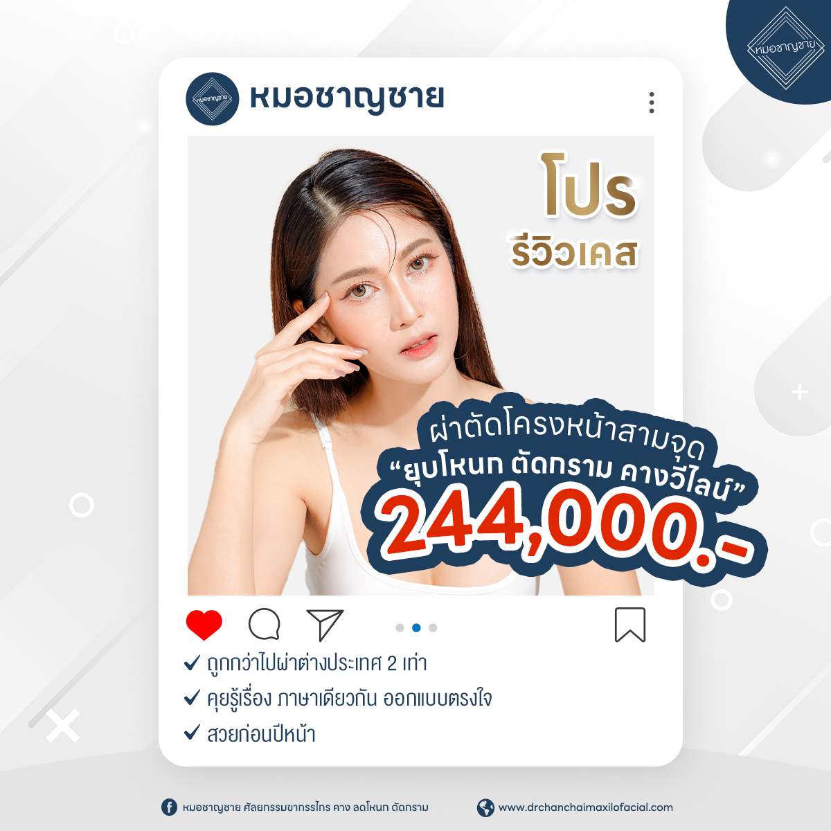 โปรรีวิวเคส “ผ่าตัดโครงหน้าสามจุด”