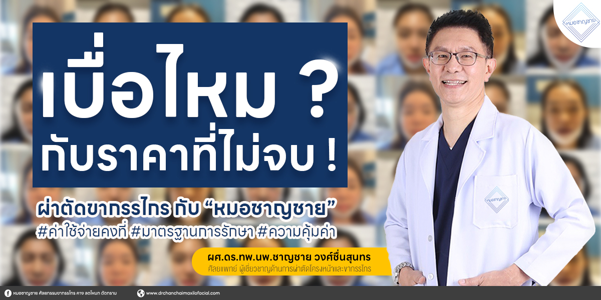 โปรโมชั่น