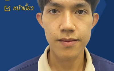 ผ่าตัดขากรรไกรก่อนจัดฟัน