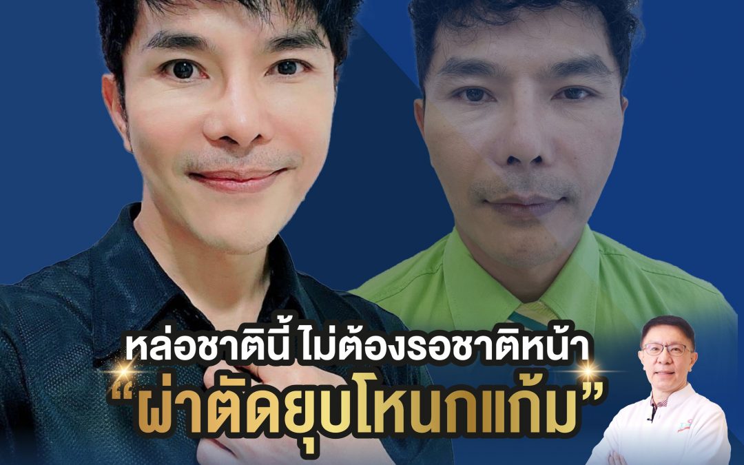 หล่อชาตินี้ ไม่ต้องรอชาติหน้า “ผ่าตัดยุบโหนกแก้ม” กับหมอชาญชาย