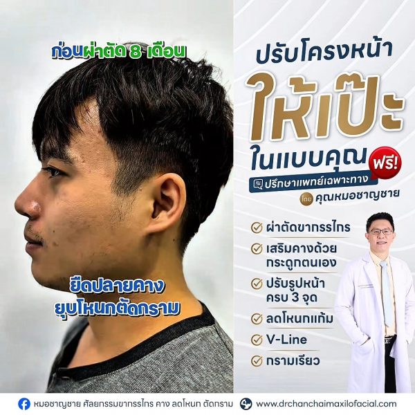 รีวิวเคสผ่าตัดโครงหน้า