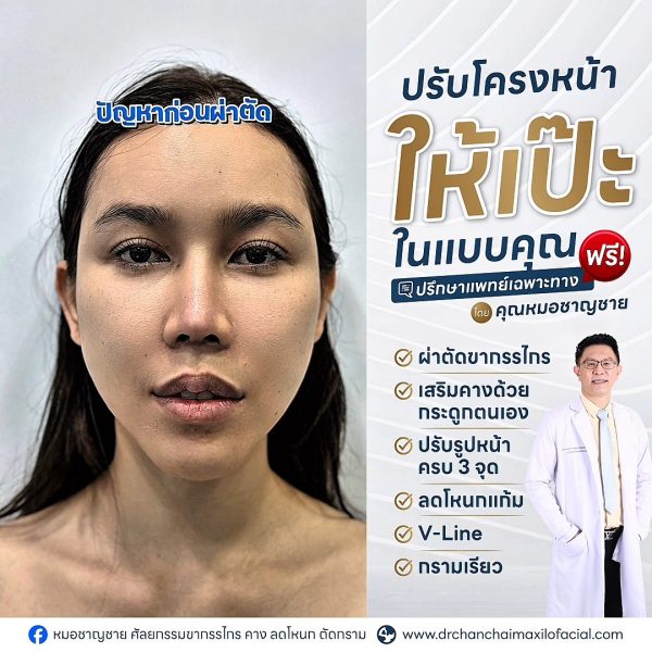 โครงหน้ายาว