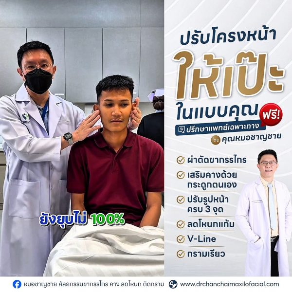 ยุบโหนกแก้ม