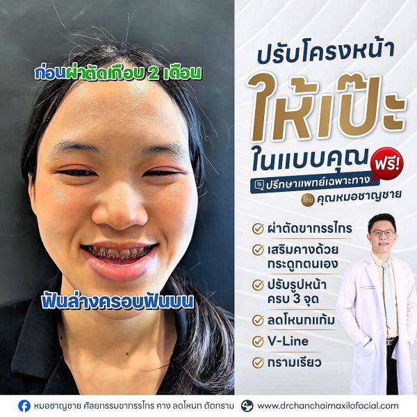 ผ่าตัดขากรรไกร