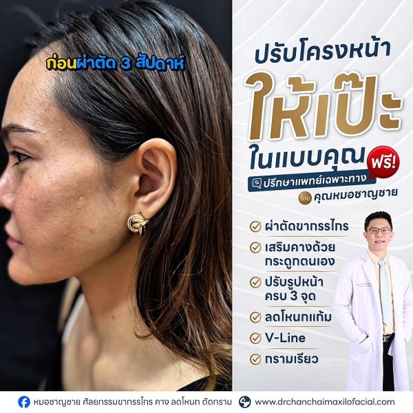 ผ่าตัดขากรรไกร