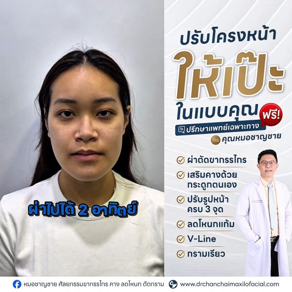 ศัลยกรรมขากรรไกร