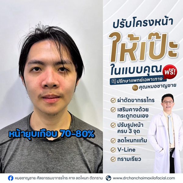 โครงหน้า