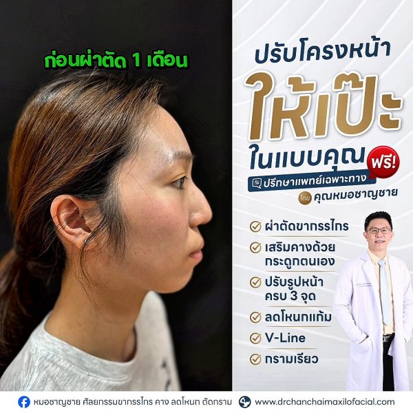 โครงหน้า