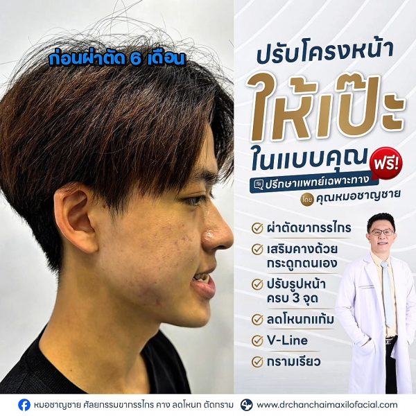 คางยื่น