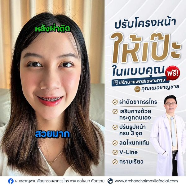 ผ่าตัดขากรรไกร