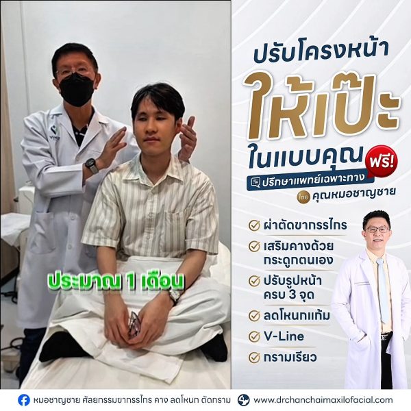 โหนกแก้มสูง