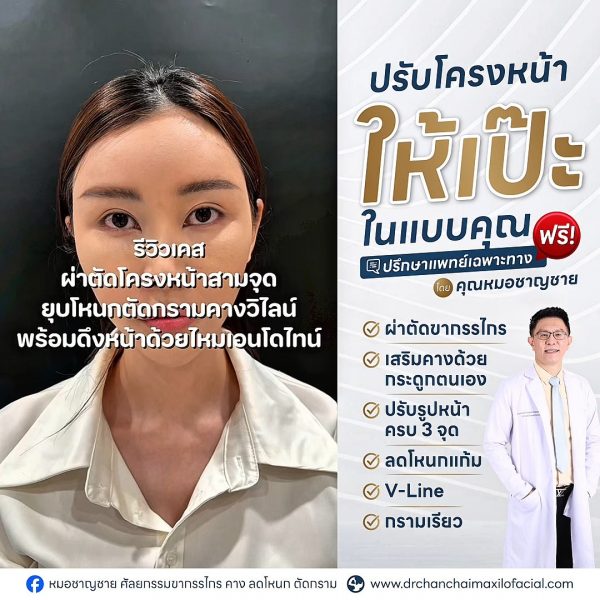โครงหน้าไม่สมดุล