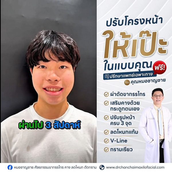 ผ่าตัดขากรรไกร