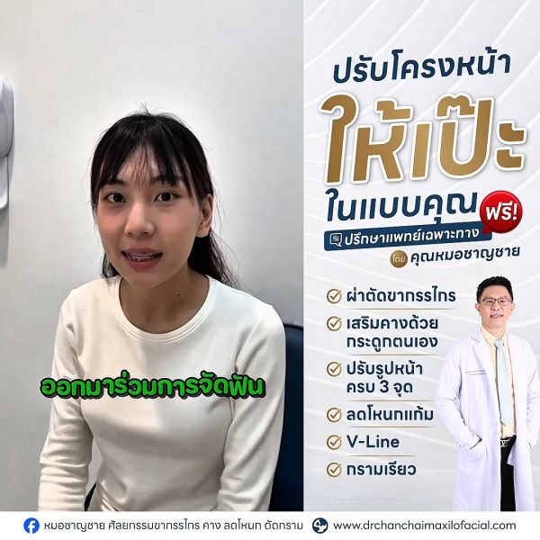 ปรับโครงหน้า