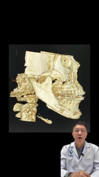 หมอชาญชาย