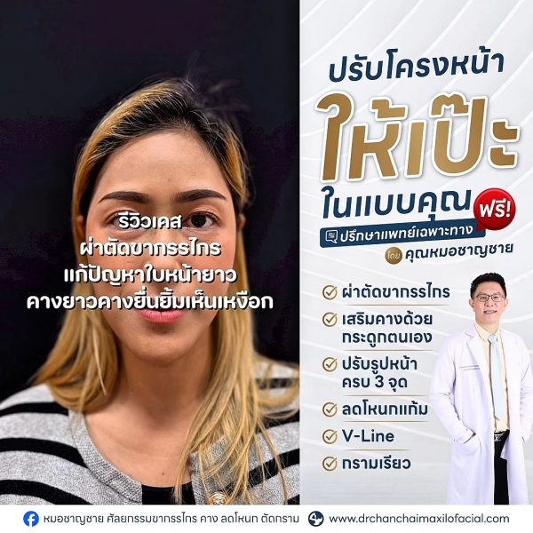 ปรับโครงหน้า