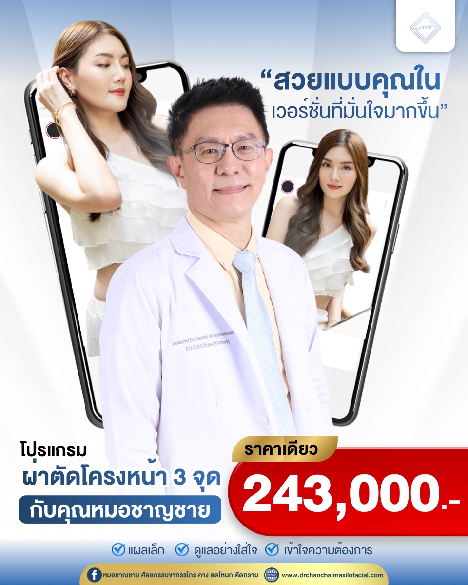 ผ่าตัดโครงหน้า