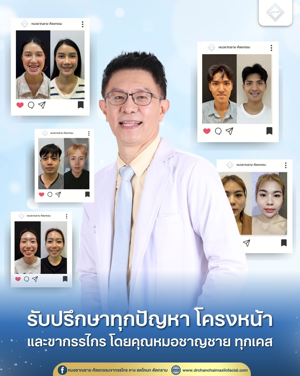 ขากรรไกร