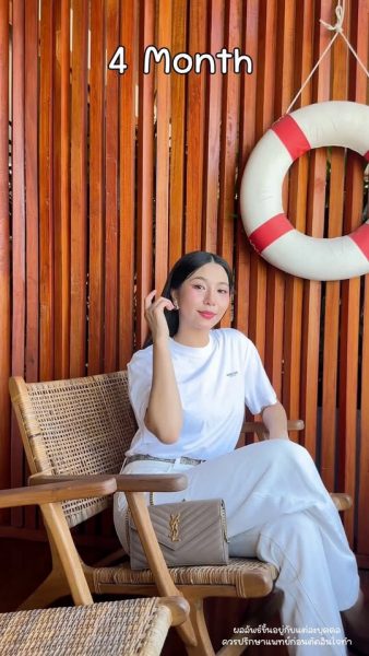ปรับโครงหน้าและคาง