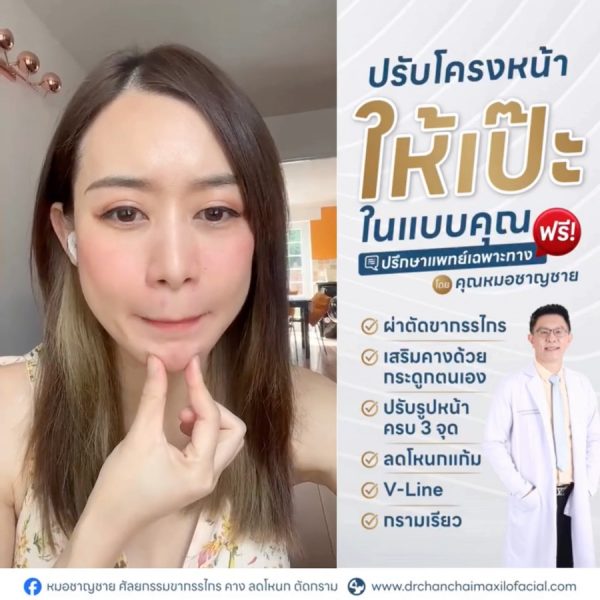 ปรับโครงหน้า