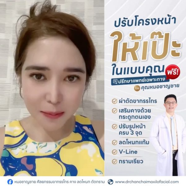 หลังตัดกราม