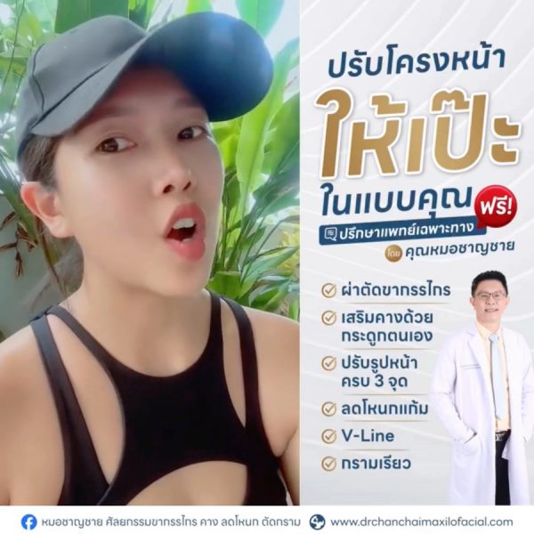 ผ่าตัด 3 จุด