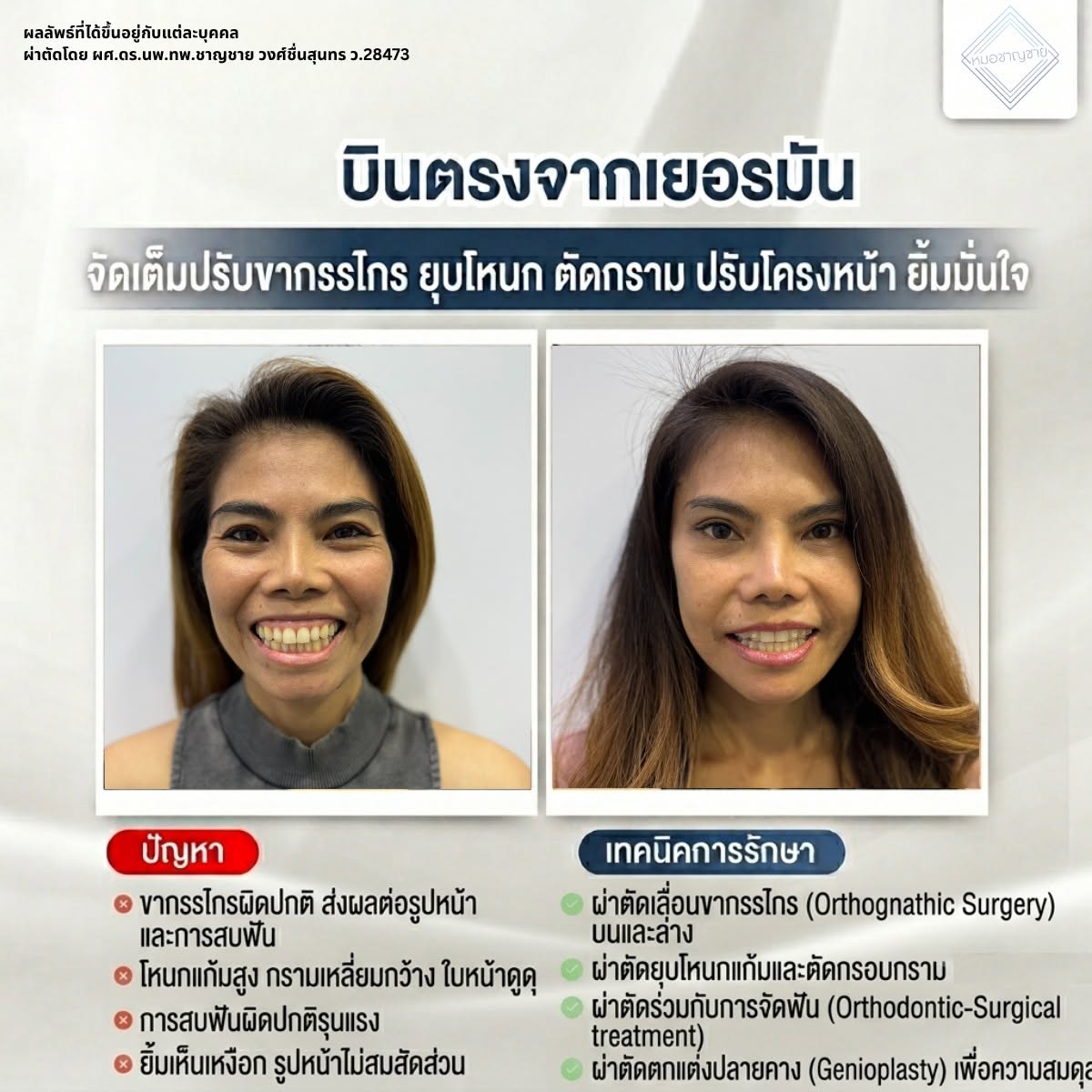 คุณหมอชาญชาย คุณหมอชาญชาย