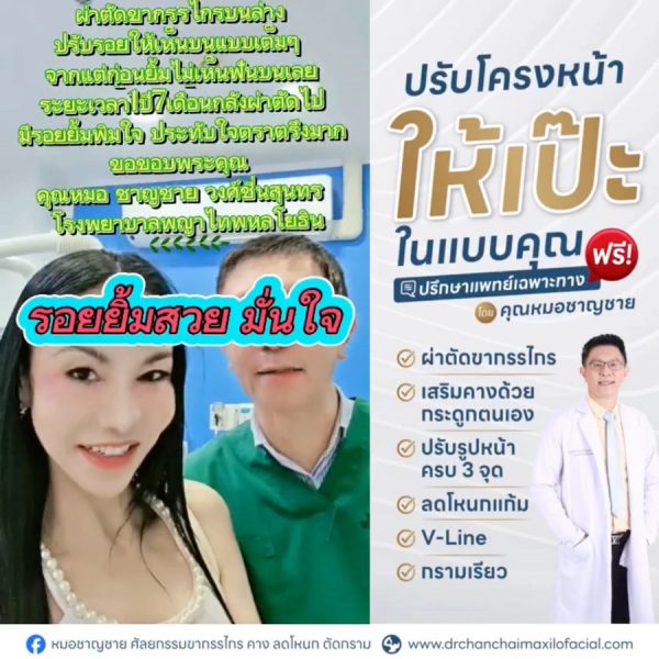 ผ่าตัดปรับโครงสร้างขากรรไกร