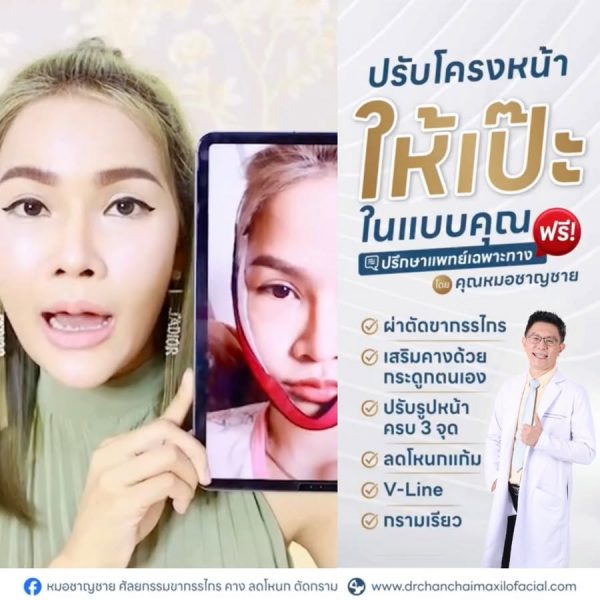 ยุบโหนก ตัดกราม