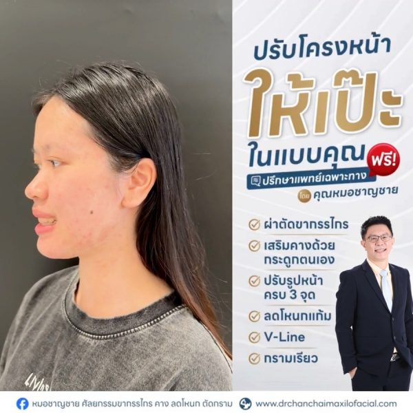 ผู้รับการรักษา