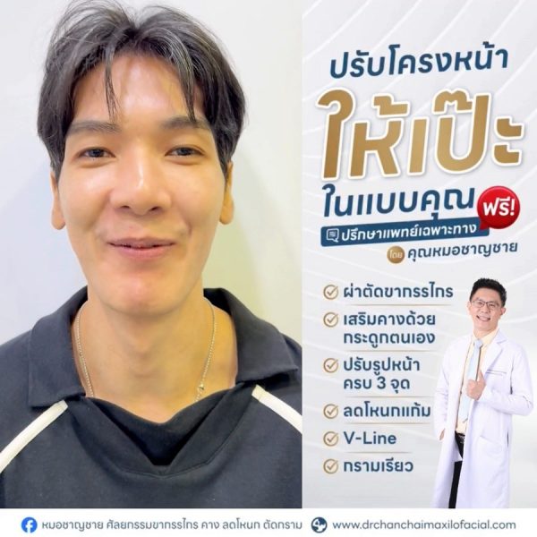 ยิ้มเห็นเหงือก