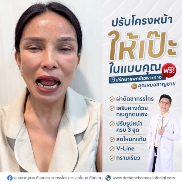 การผ่าตัดแก้