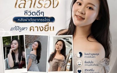 ให้ภาพเล่าเรื่อง…ของชีวิตที่เปลี่ยนไปหลังผ่าตัดขากรรไกร