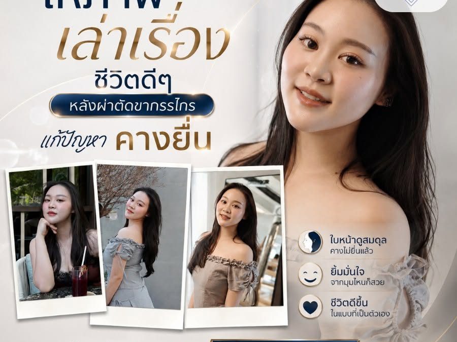 ให้ภาพเล่าเรื่อง…ของชีวิตที่เปลี่ยนไปหลังผ่าตัดขากรรไกร