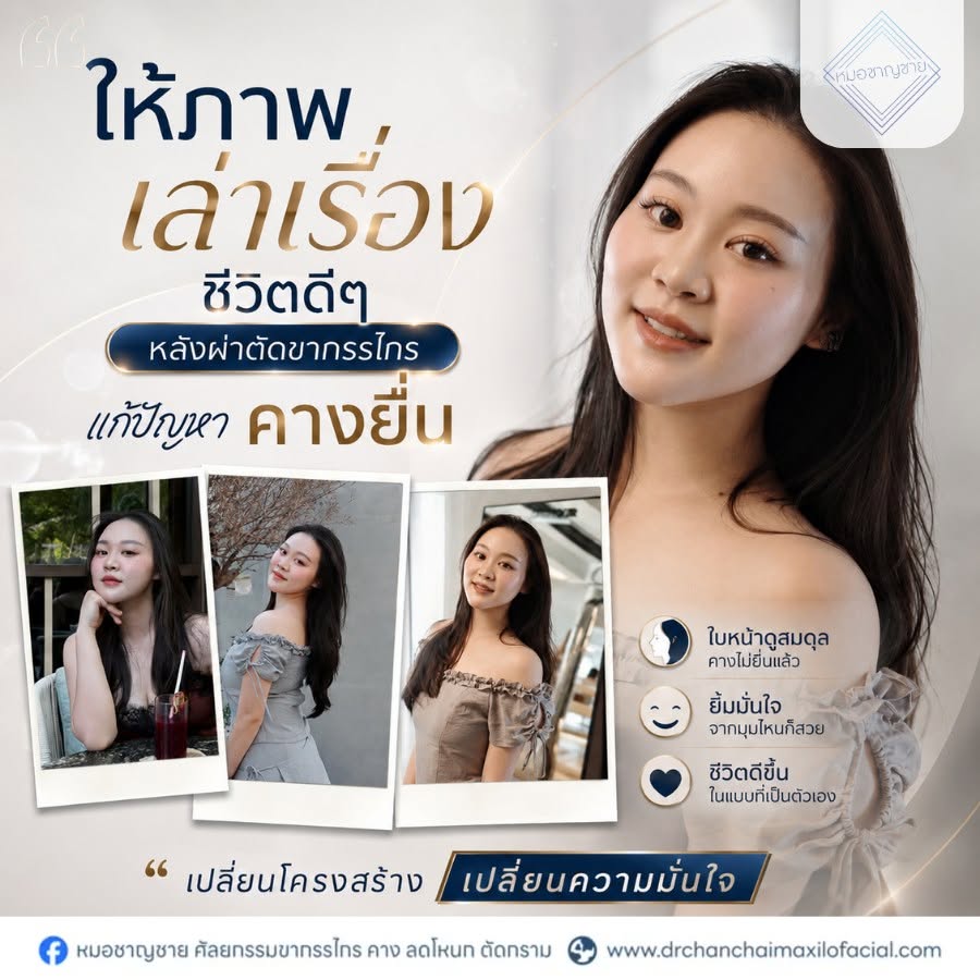 ผ่าตัดขากรรไกร ผ่าตัดขากรรไกร