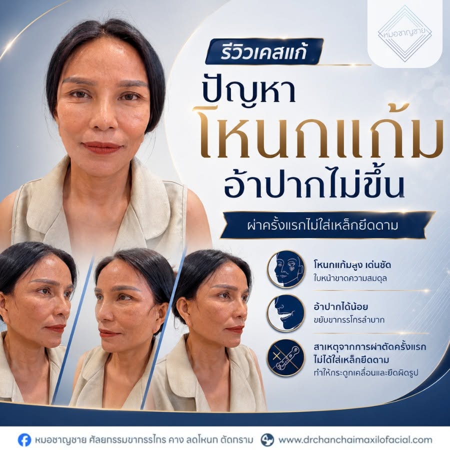 ผ่านการผ่าตัดมาก่อน ผ่านการผ่าตัดมาก่อน
