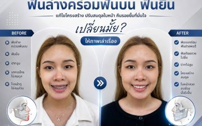 ปัญหาขากรรไกรและฟันไม่สมสัดส่วน
