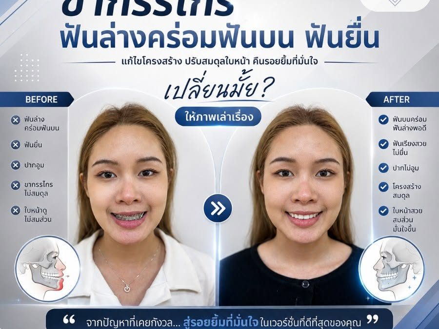 ปัญหาขากรรไกรและฟันไม่สมสัดส่วน