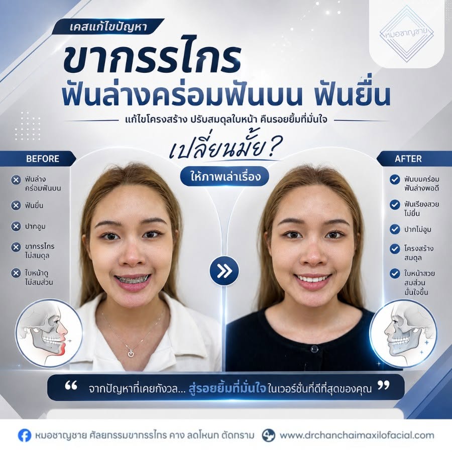 ปัญหาขากรรไกร