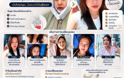 สรุปรีวิวจัดเต็ม! ปรับโครงหน้าวีไลน์ในไทย เปลี่ยนชีวิตให้มั่นใจ!