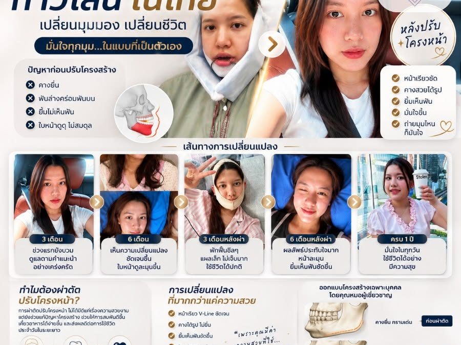 สรุปรีวิวจัดเต็ม! ปรับโครงหน้าวีไลน์ในไทย เปลี่ยนชีวิตให้มั่นใจ!