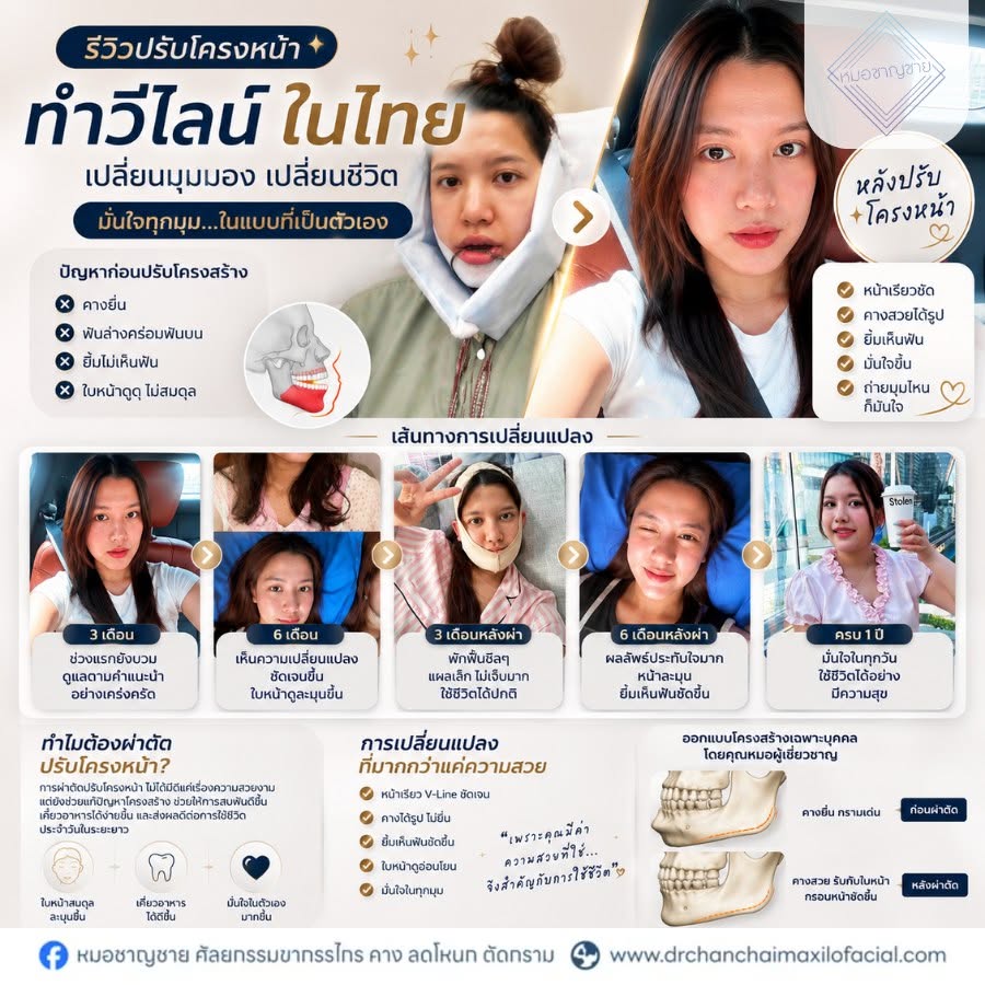 ปรับโครงหน้าวีไลน์