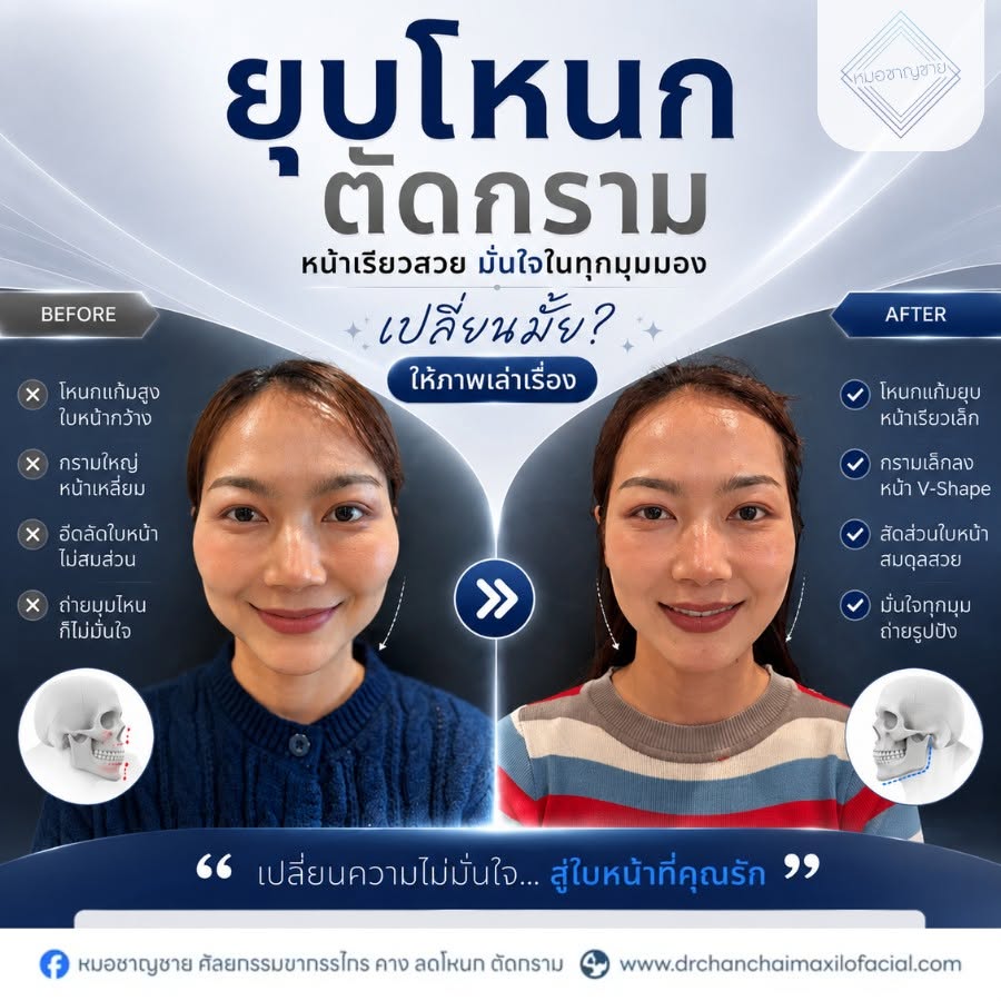 ตัดกราม