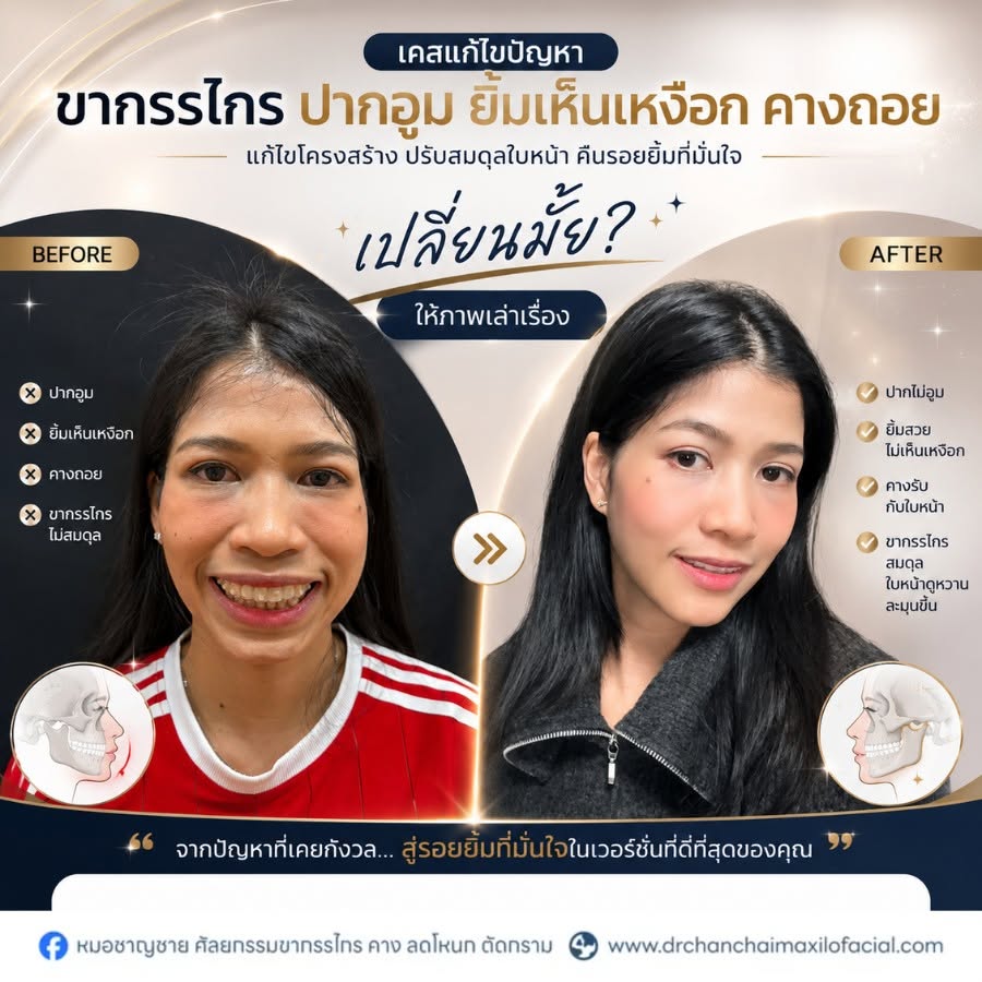 ปัญหาปากอูม