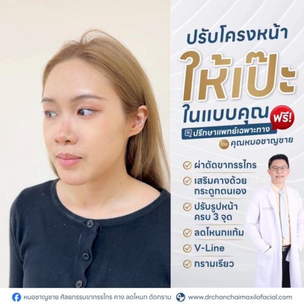 ผ่าตัดขากรรไกร