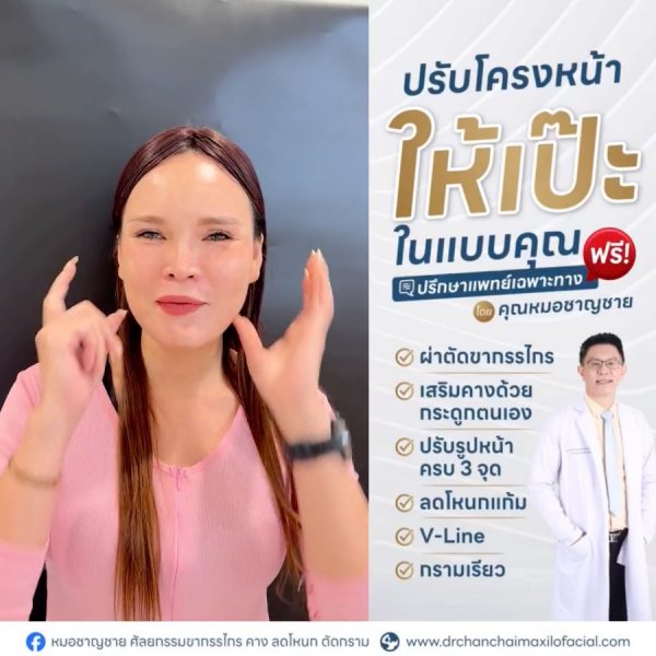 ผ่าตัดโครงหน้า